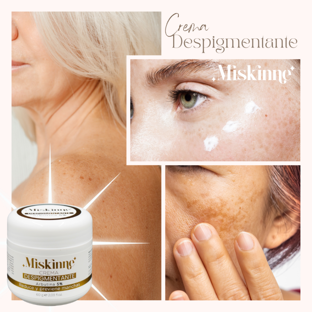 Crema Despigmentante - Miskinne